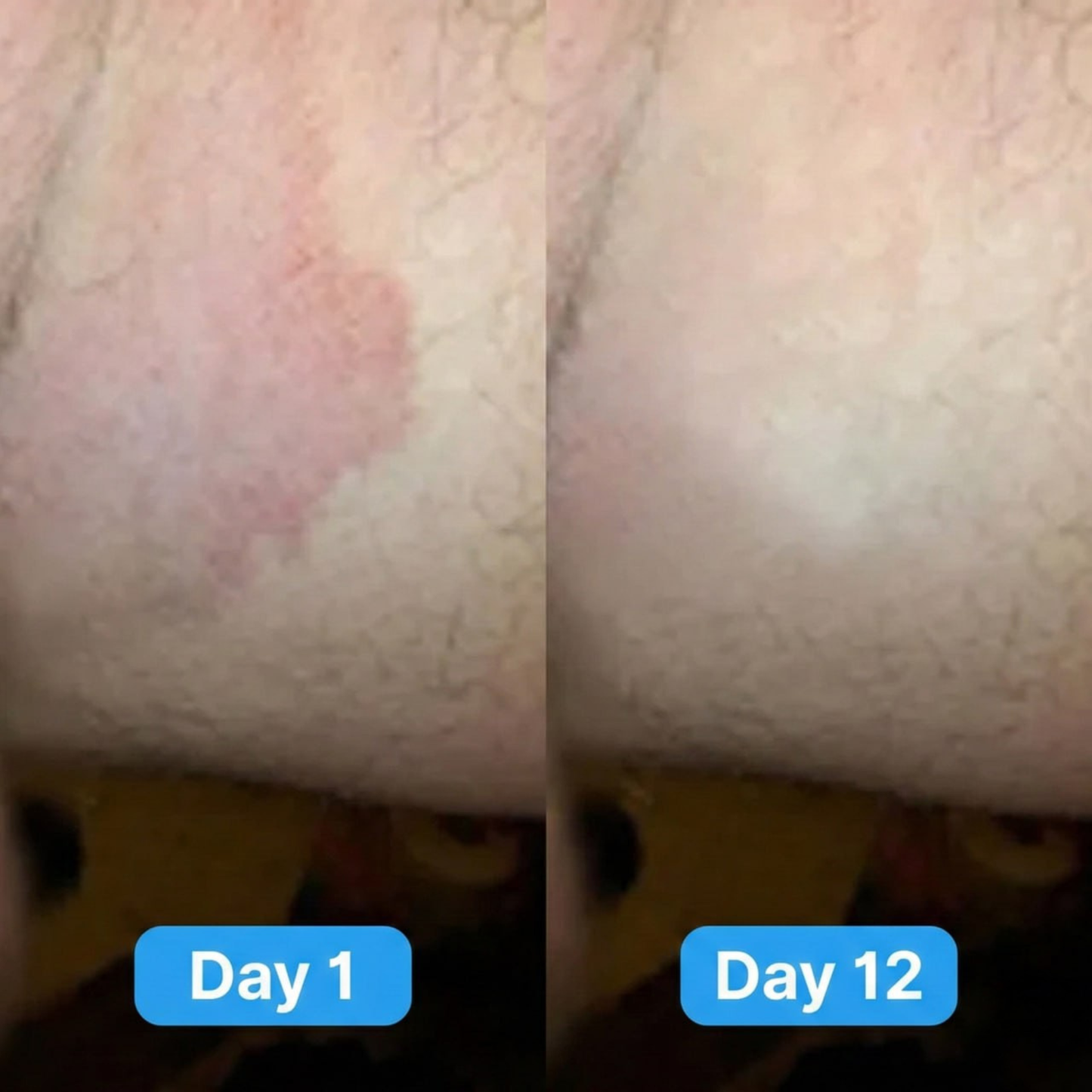 Gentry Antifungal Cream®